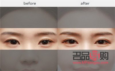 雙眼皮是什么眼睛