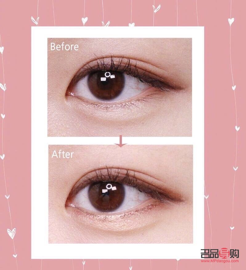 臥蠶眼：魅力之眼，靈動(dòng)之韻