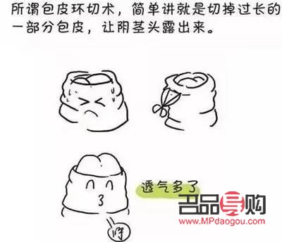 美容包皮手術(shù)嗎(美容包皮手術(shù)嗎會復發(fā)嗎)