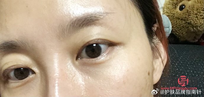 <h3>天生腫眼泡熱敷是否有用？</h3>