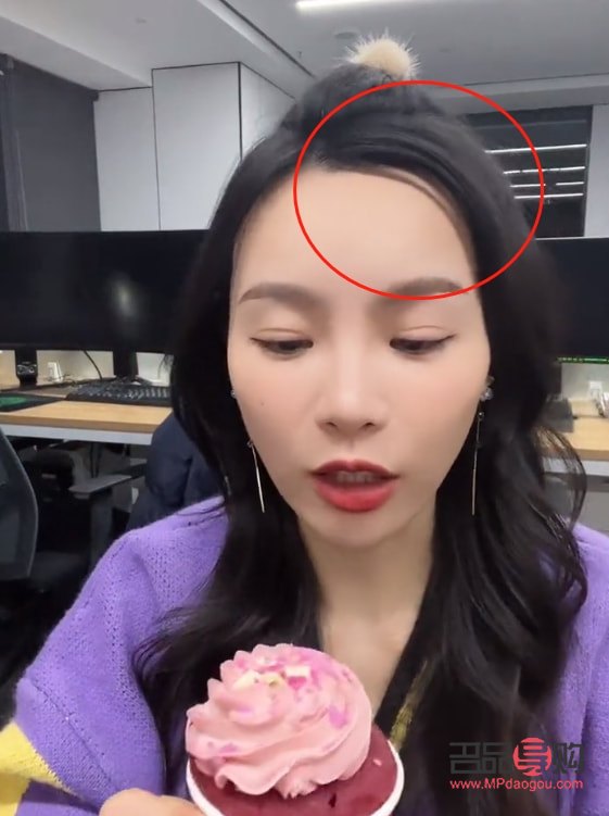 眼窩凹陷可以填充玻尿酸嗎(眼窩凹陷可以填充玻尿酸嗎視頻)