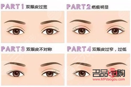 雙眼皮圖片 效果圖女生(雙眼皮圖片 效果圖女生可愛(ài))