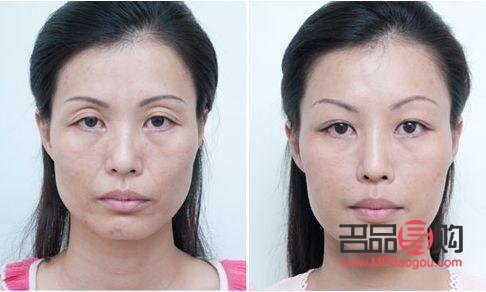 美容油能不能用(美容油能不能用在臉上)