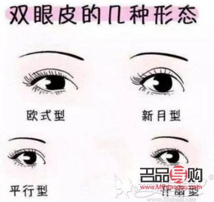 扇形雙眼皮與開(kāi)扇形雙眼皮：兩者是否相同？