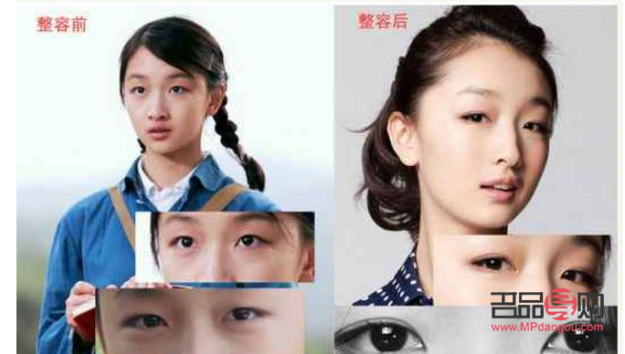 眼皮埋線和割雙眼皮有什么區(qū)別(眼皮埋線和割雙眼皮有什么區(qū)別嗎)