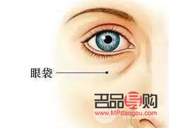 內(nèi)切眼袋需要拆線嗎(內(nèi)切眼袋需要拆線嗎圖片)