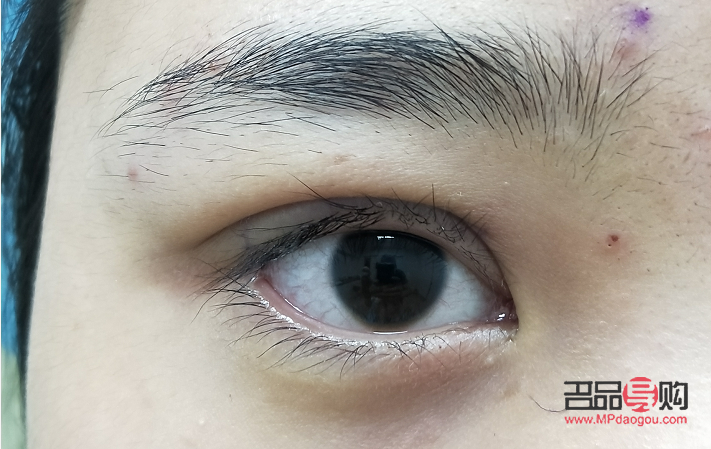 <h3>全切雙眼皮：塑造迷人電眼的秘密武器</h3>