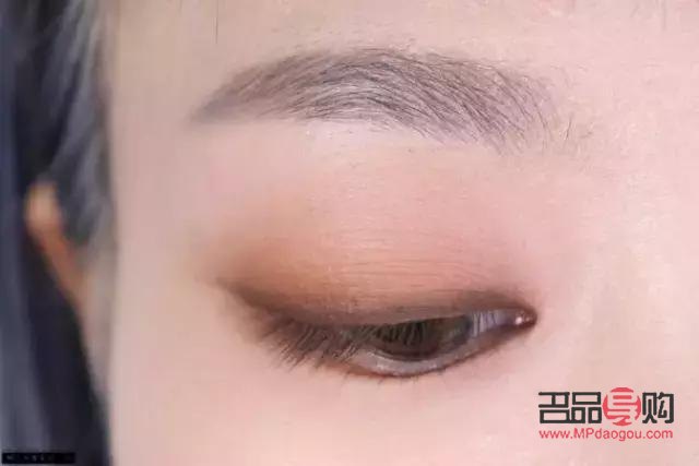 全切雙眼皮手術過程視頻教程(全切雙眼皮手術過程視頻教程大全)