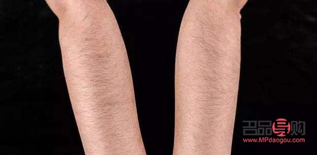 身體四種毛發(fā)怎么護(hù)理(身體四種毛發(fā)怎么護(hù)理的)