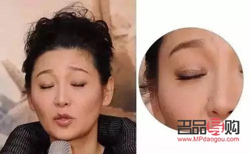 大眼綜合與小眼綜合：眼部整形手術(shù)的不同選擇