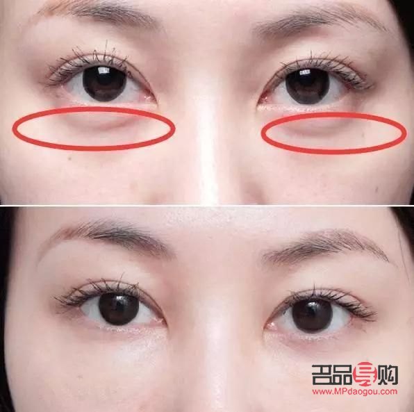 小孩眼袋是怎樣產(chǎn)生的如何消除(小孩眼袋是怎樣產(chǎn)生的,如何消除)