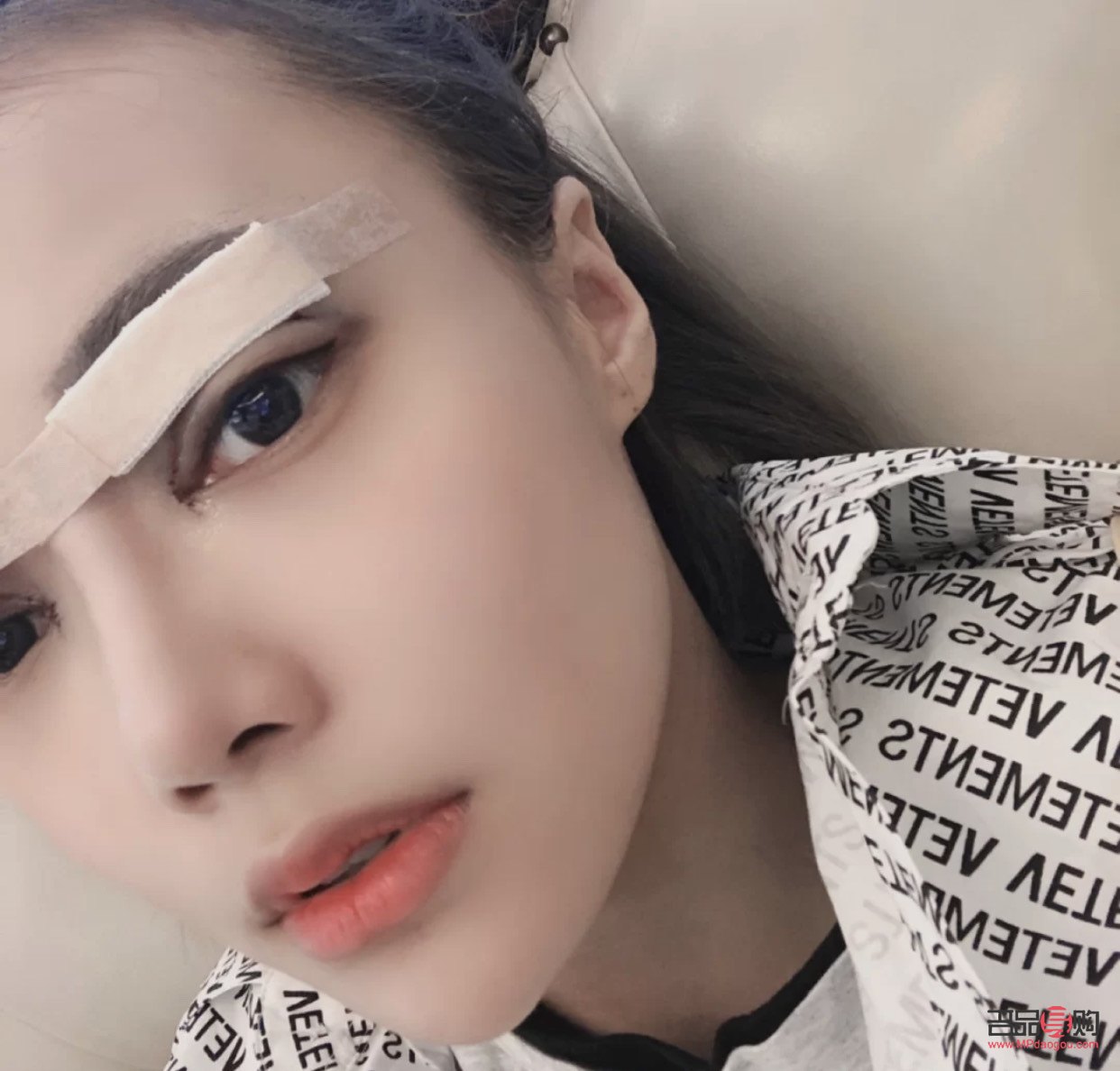 <h3>天生眼泡腫怎么辦？有效緩解眼泡腫脹的方法與建議</h3>