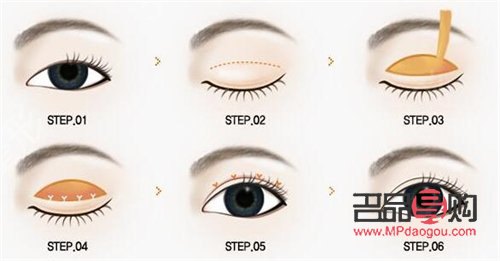 <h3>重塑青春明眸：探索眼皮下垂恢復之道</h3>