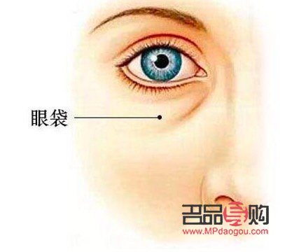 <h3>告別眼袋困擾，重拾青春明眸</h3>