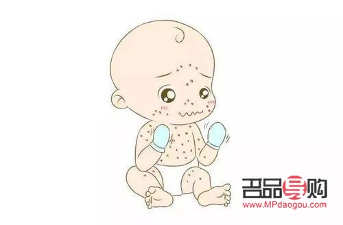 有水痘該怎么護理身體(有水痘該怎么護理身體呢)