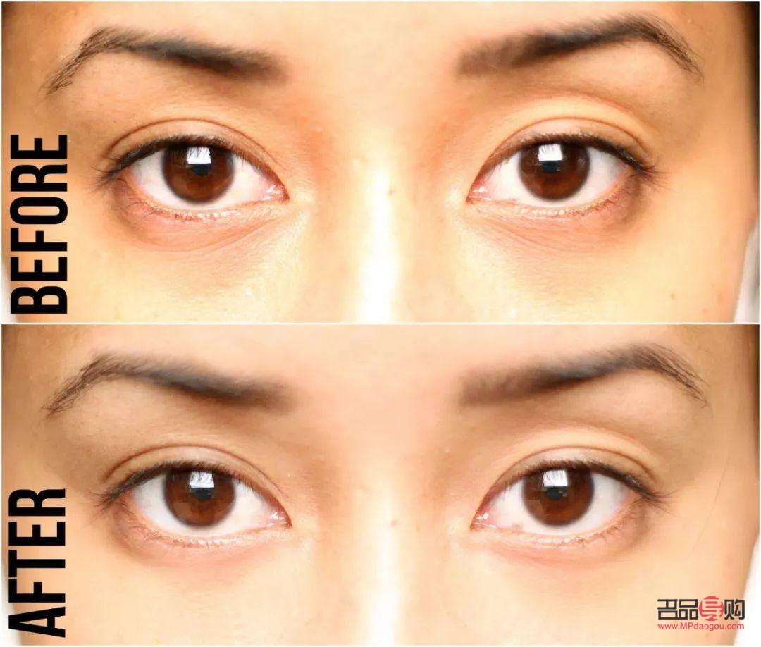 消除腫眼泡的眼霜(消除腫眼泡的眼霜有用嗎)
