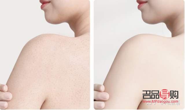 <h3>身體護理是否需要脫衣服？</h3>