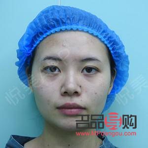 雙眼皮那種款式最好看(雙眼皮那種款式最好看圖片)