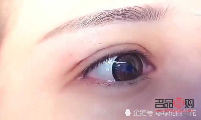 腫眼泡適合哪種雙眼皮貼(腫眼泡適合哪種雙眼皮貼好)