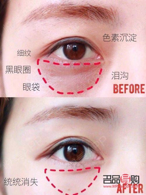 <h3>淚溝化妝技巧：如何巧妙遮住眼袋</h3>