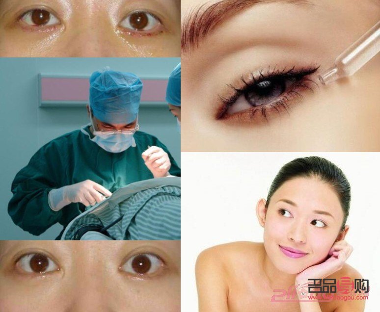 眼袋抽脂手術(shù)視頻(割眼袋視頻過程高清圖片)