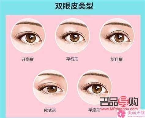 雙眼皮手術(shù)能否二次操作及費用探討