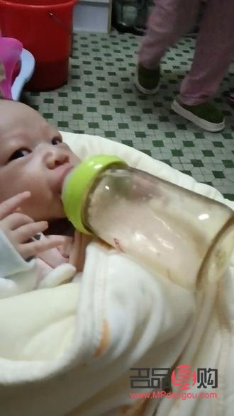 一覺醒來三眼皮怎么恢復雙眼皮(一覺醒來變三眼皮迅速恢復雙眼皮)