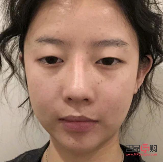 雙眼皮有幾種類型圖片大全集(雙眼皮有幾種類型圖片大全集圖解)