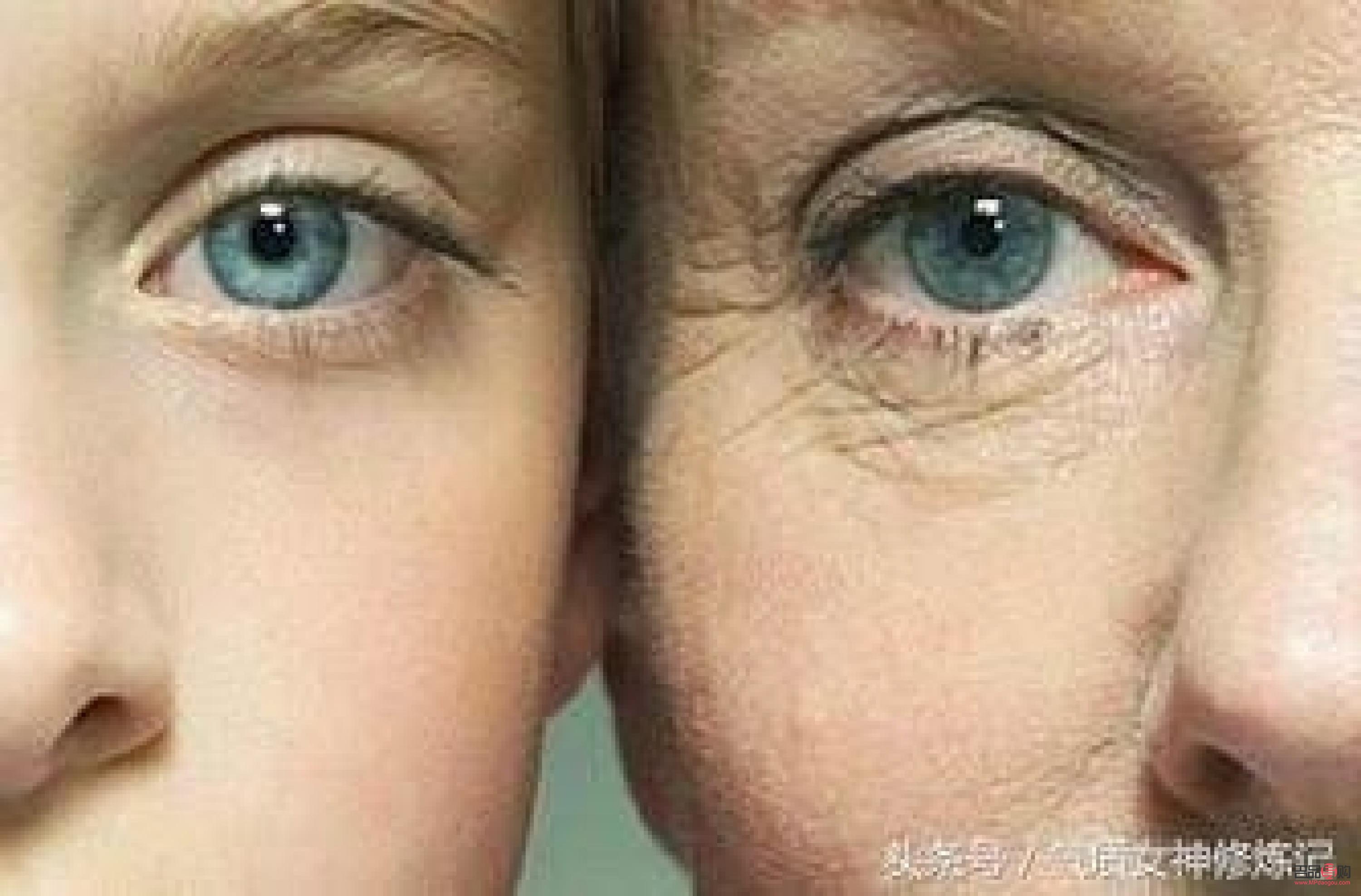 眼部皺紋消除最好方法視頻(眼部皺紋消除最好方法視頻講解)