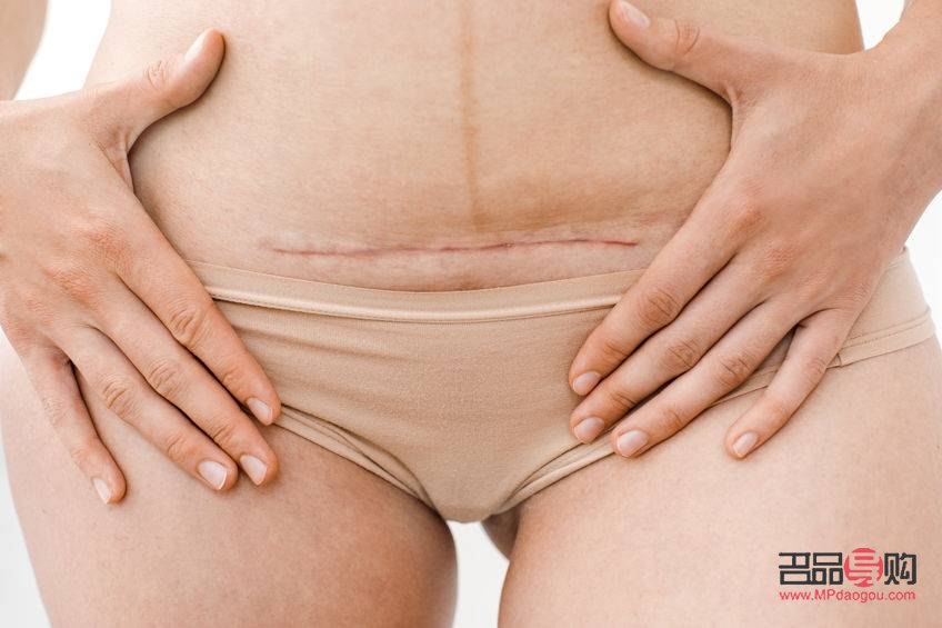 剖腹產(chǎn)前怎么護(hù)理身體(剖腹產(chǎn)前怎么護(hù)理身體好)