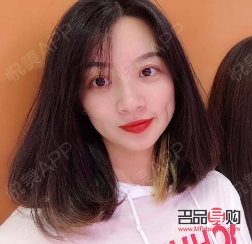 <h3>打針美容：美麗新選擇的風(fēng)險與考量</h3>