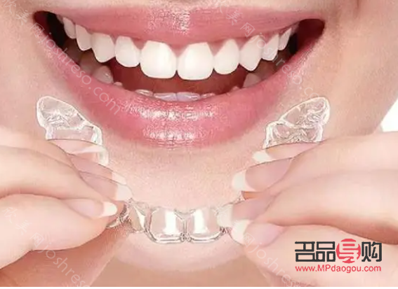 美容牙套多少錢(qián)(美容牙套多少錢(qián)一個(gè))