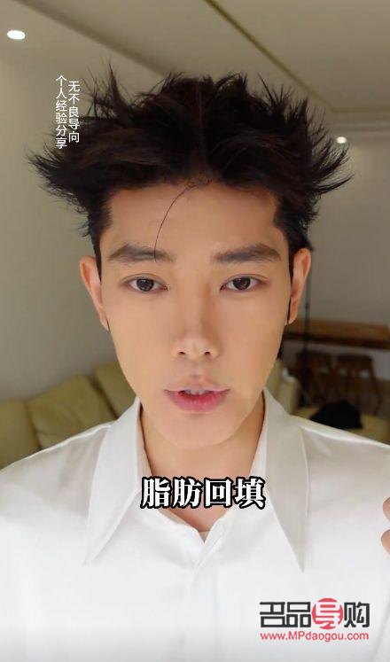 眼眶凹陷怎么恢復(fù)飽滿 中醫(yī)調(diào)理(眼眶凹陷怎么恢復(fù)飽滿 中醫(yī)調(diào)理方法)