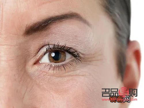 眼睛下面干紋越來越多怎么辦(眼下已經(jīng)形成的干紋怎么去除)