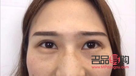 上眼瞼提肌手術(shù)圖解(上眼瞼提肌手術(shù)圖解視頻)