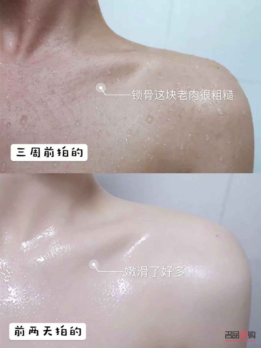 明星身體干燥怎么護(hù)理(明星身體干燥怎么護(hù)理好)