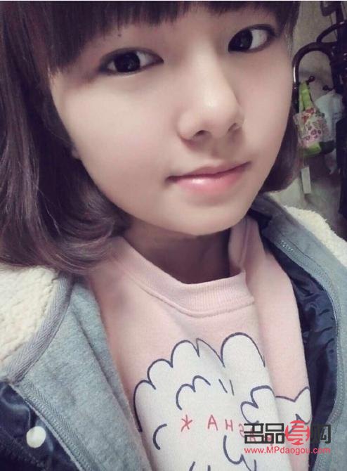 雙眼皮8mm三個(gè)月后還沒(méi)消腫(雙眼皮8mm三個(gè)月后還沒(méi)消腫正常嗎)