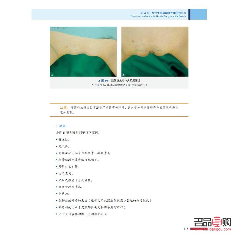 <h3>美容瘢痕：了解、預(yù)防與治療</h3>