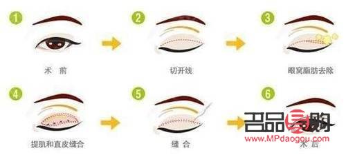 眼綜合是指哪些項(xiàng)目(眼綜合是指什么)