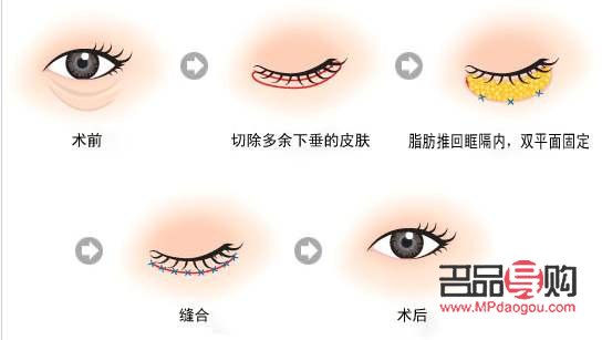 眼綜合是指哪些項(xiàng)目(眼綜合是指什么)