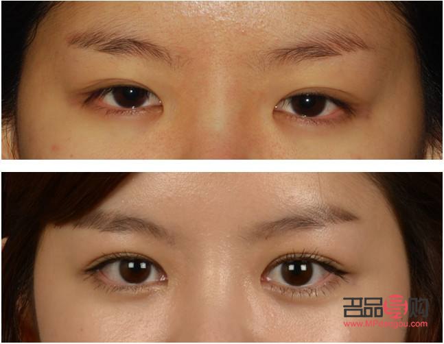 怎樣能讓內(nèi)雙眼皮變外雙眼皮視頻(怎樣能讓內(nèi)雙眼皮變外雙眼皮視頻講解)