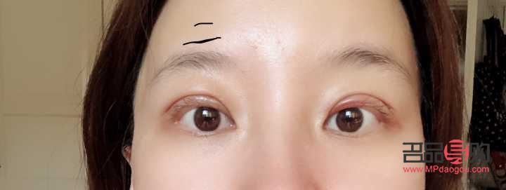 大小眼可以通過雙眼皮手術(shù)改善嗎(大小眼可以通過雙眼皮手術(shù)改善嗎)