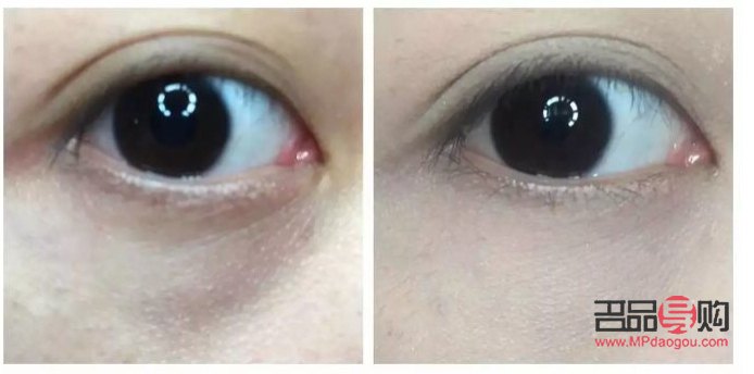 消除水腫眼霜推薦：告別泡泡眼，重拾明亮神采