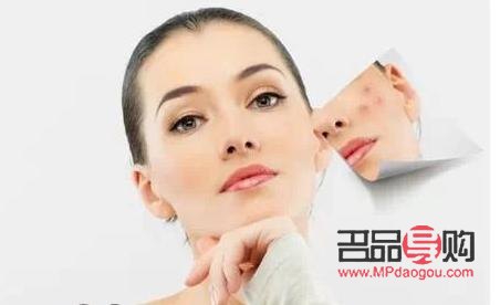 身體護(hù)理刷酸有用嗎(身體護(hù)理刷酸有用嗎女生)