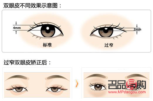 雙眼皮美學(xué)：哪款雙眼皮款式最受青睞？