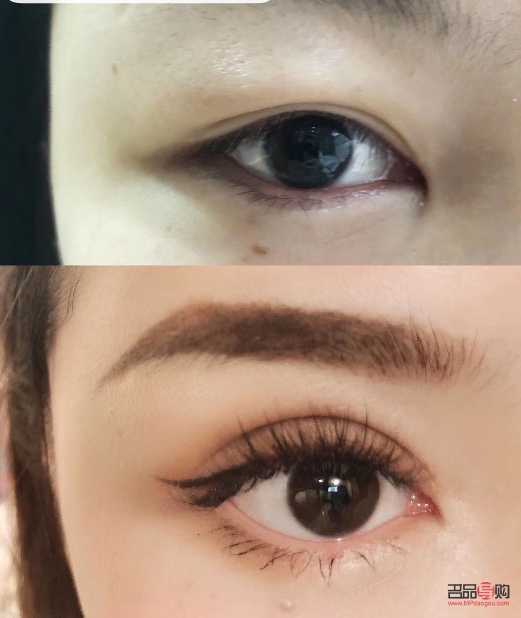 <h3>天生腫泡眼可以消除嗎？專業(yè)解讀與應(yīng)對(duì)方法</h3>