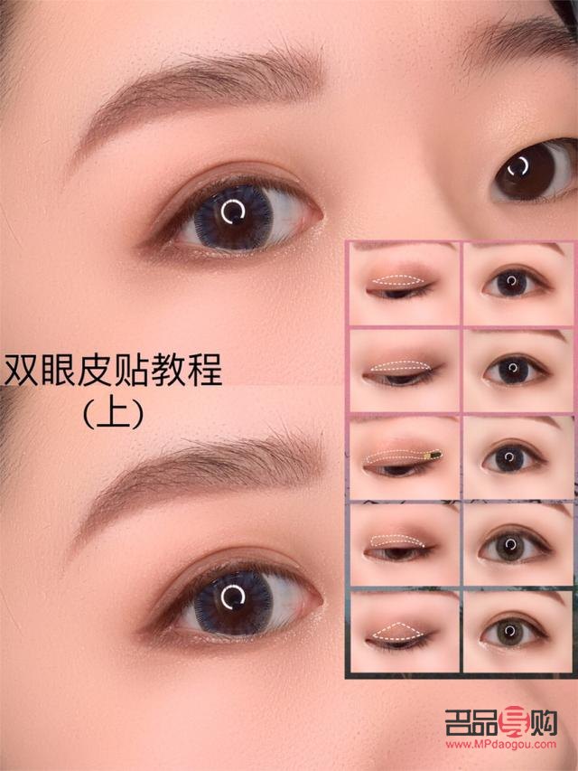 天生腫泡眼可以消除嗎？專業(yè)解讀與應(yīng)對(duì)方法