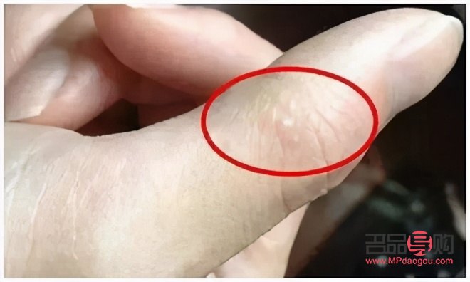 做身體護(hù)理怎么會(huì)癢(做身體護(hù)理怎么會(huì)癢癢的)