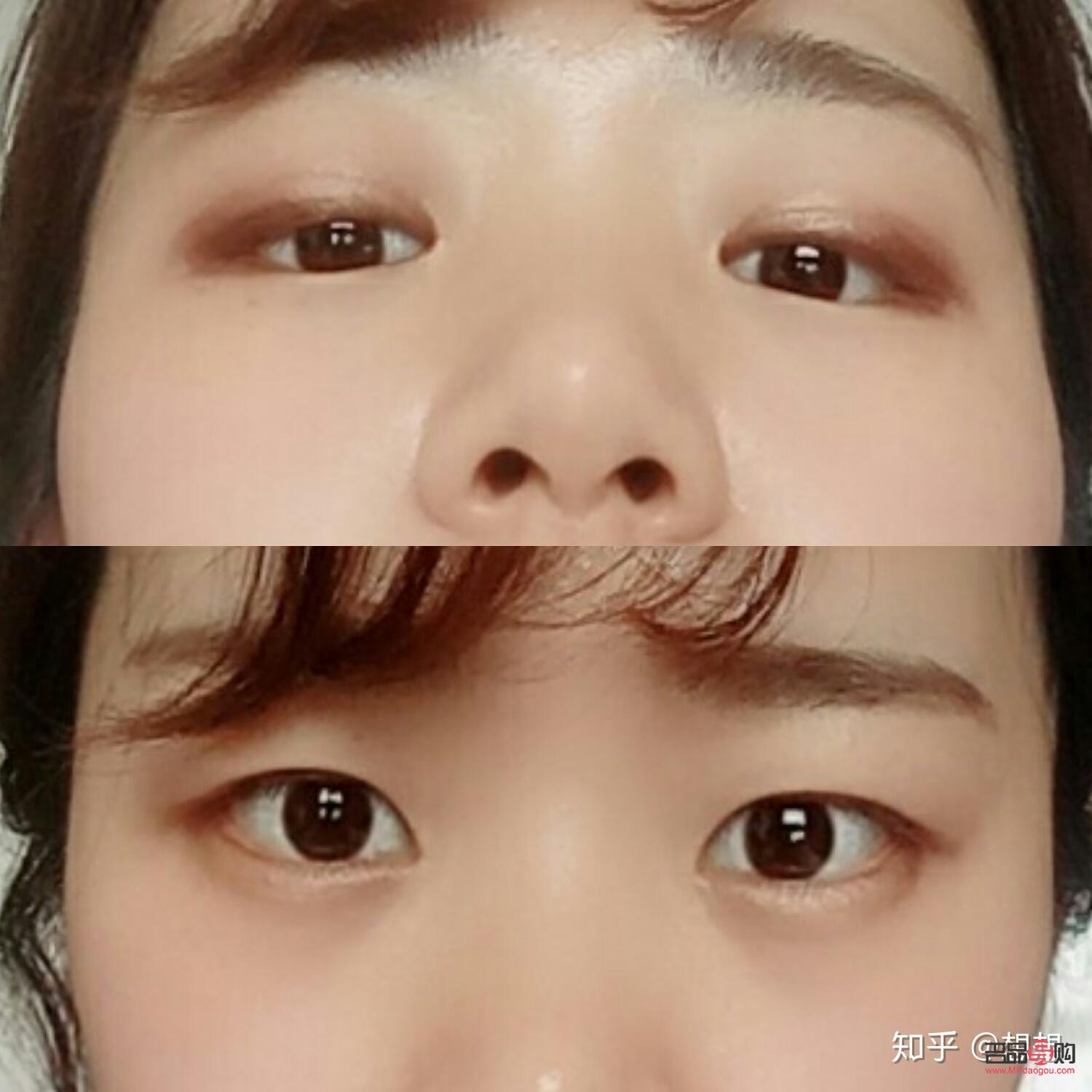 <h3>后天腫泡眼自我改善指南</h3>