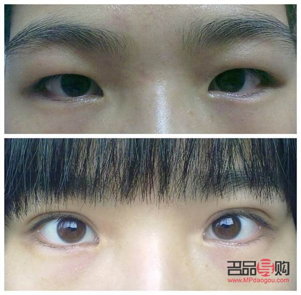 <h3>天生腫眼泡不手術(shù)，如何有效改善？</h3>